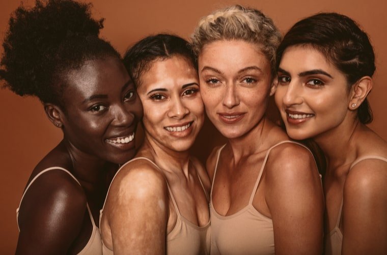 Vitiligo, la piel que pierde su color
